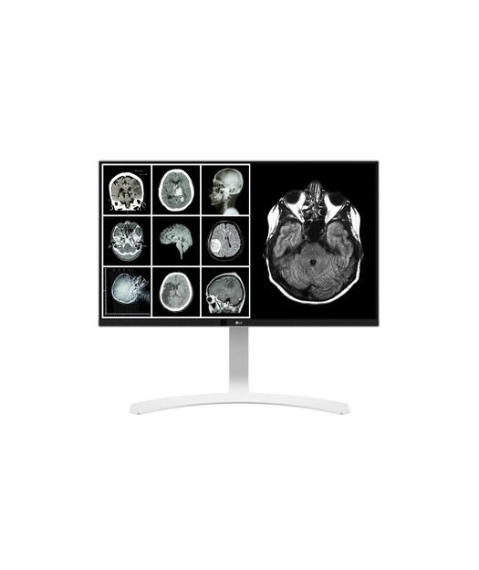 LG 27'' 8MP IPS Clinical Review Monitör